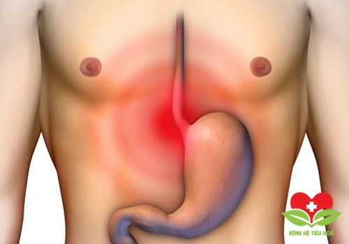 Đừng bao giờ chủ quan với những triệu chứng của bệnh xuất huyết dạ dày Đừng bao giờ chủ quan với những triệu chứng của bệnh xuất huyết dạ dày