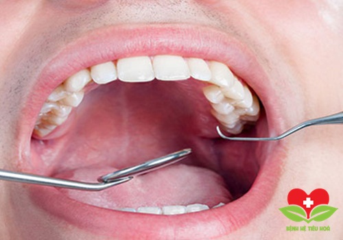 Vận động của lưỡi và tri giác bị hạn chế Vận động của lưỡi và tri giác bị hạn chế