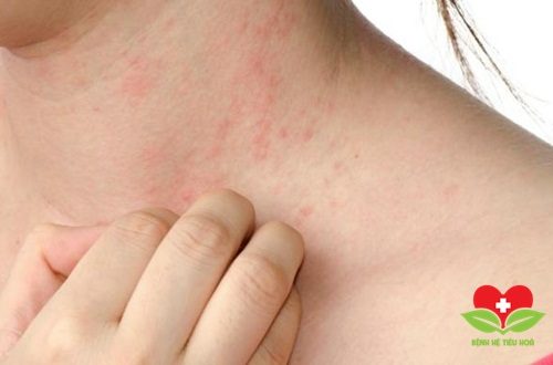 Da bị phát ban và kích ứng