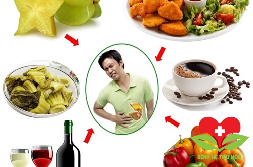 Thực phẩm đại kỵ không nên ăn khi bị đau dạ dày