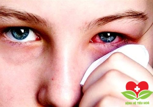 Nguyên tắc cơ bản trong điều trị phỏng mắt chuẩn Bộ Y tế