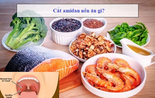 Sau khi cắt amidan bệnh bệnh nhân cần đặc biệt chú trọng vào chế độ ăn uống